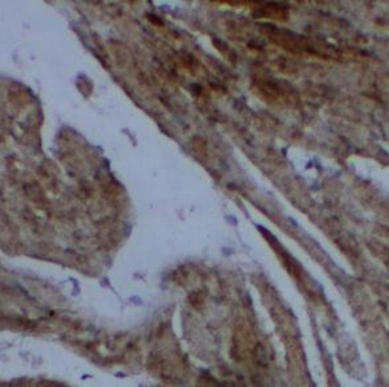 CASP7 Rabbit Polyclonal Antibody