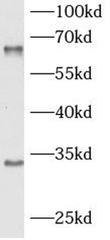 HAVCR2 Mouse Monoclonal Antibody