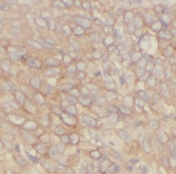 HAVCR2 Mouse Monoclonal Antibody