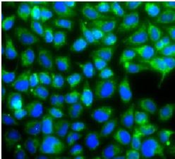 USP10 Rabbit Polyclonal Antibody