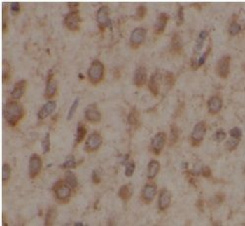 USP10 Rabbit Polyclonal Antibody