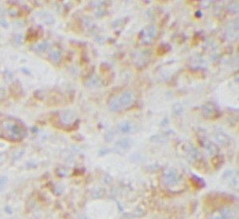 HSPG2 Rabbit Polyclonal Antibody