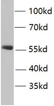 FGR Rabbit Polyclonal Antibody