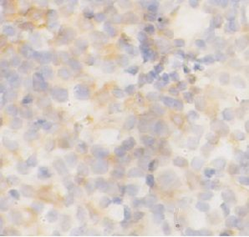 FGR Rabbit Polyclonal Antibody
