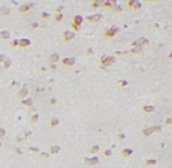 GRM2 Rabbit Polyclonal Antibody
