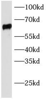 SLC22A6 Antibody