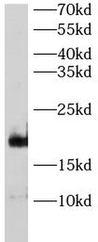 CAV3 Rabbit Polyclonal Antibody