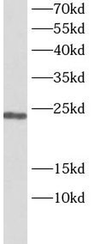 PTTG1 Antibody