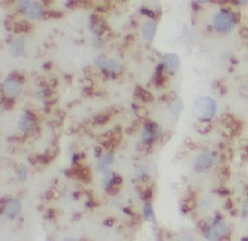 IL5 Antibody