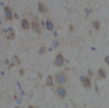 TAB2 Antibody