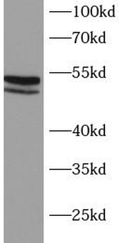 MAP2K7 Rabbit Polyclonal Antibody