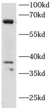 IRAK3 Antibody
