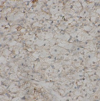 PAX4 Rabbit Polyclonal Antibody