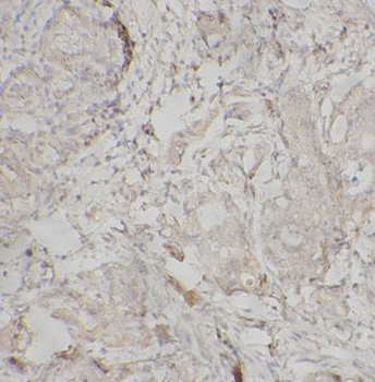 EZH2 Rabbit Polyclonal Antibody