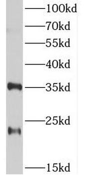 TSPAN12 Rabbit Polyclonal Antibody