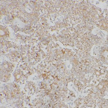 TSPAN12 Rabbit Polyclonal Antibody