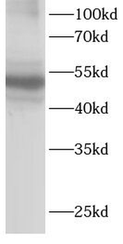 TEC Rabbit Polyclonal Antibody