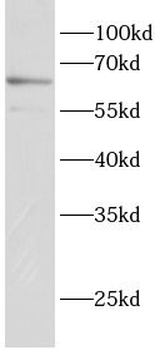 ETV6 Rabbit Polyclonal Antibody