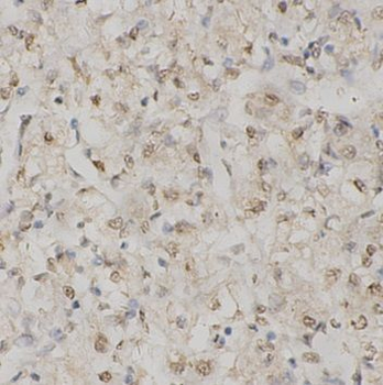 SKI Rabbit Polyclonal Antibody