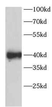 SIRT6 Rabbit Polyclonal Antibody