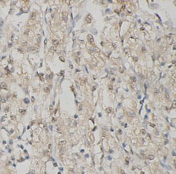 SIRT6 Rabbit Polyclonal Antibody
