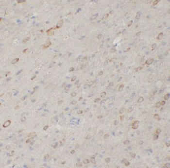 SFTPB Rabbit Polyclonal Antibody