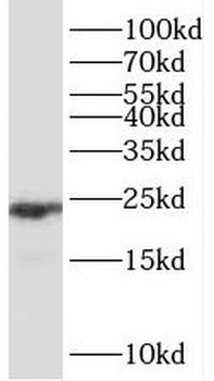 PPIB Rabbit Polyclonal Antibody