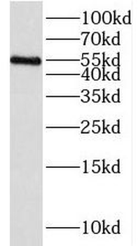 IRAK4 Rabbit Polyclonal Antibody