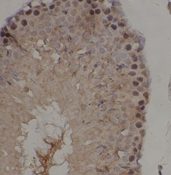 IRAK4 Rabbit Polyclonal Antibody