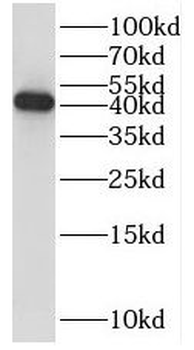 TRAM1 Rabbit Polyclonal Antibody