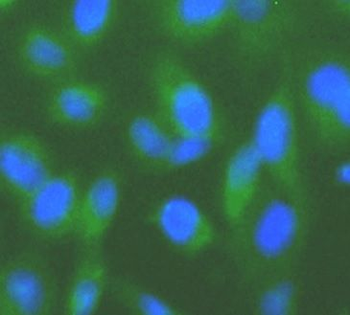 SUMO1 Rabbit Polyclonal Antibody