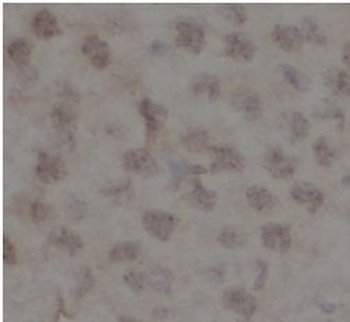 SUMO1 Rabbit Polyclonal Antibody