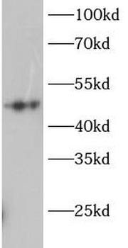 GSK3A Rabbit Polyclonal Antibody