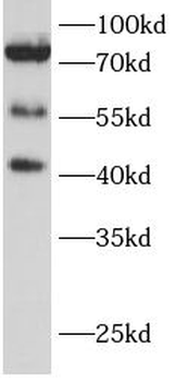 MAVS Rabbit Polyclonal Antibody