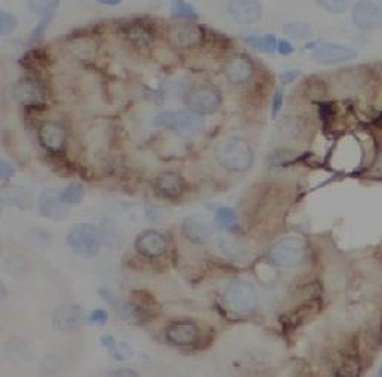 GCLM Rabbit Polyclonal Antibody