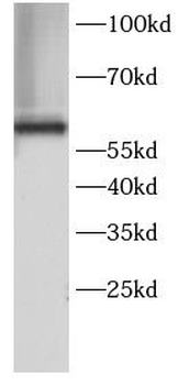 HSPD1 Antibody