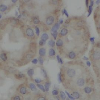 HSPD1 Antibody