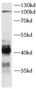 SHARPIN Antibody