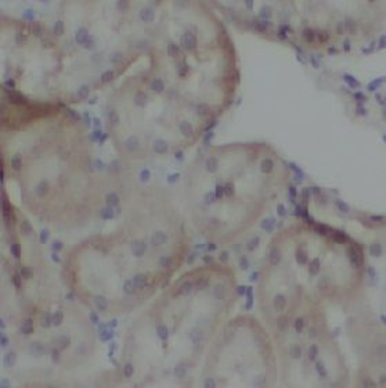 INPPL1 Antibody