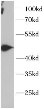 PTPN1 Rabbit Polyclonal Antibody