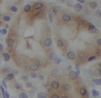 PTPN1 Rabbit Polyclonal Antibody