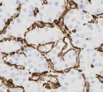 ABCB11 Rabbit Polyclonal Antibody