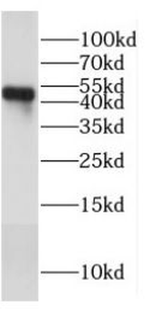 SARS-CoV-2 N protein Antibody