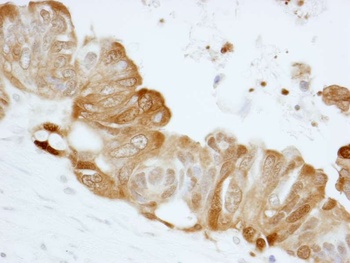Rabbit 14-3-3 Sigma IHC Antibody