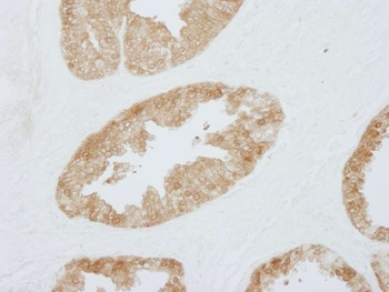 Rabbit 14-3-3 Sigma IHC Antibody