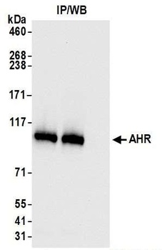 Rabbit AHR Recombinant Monoclonal Antibody