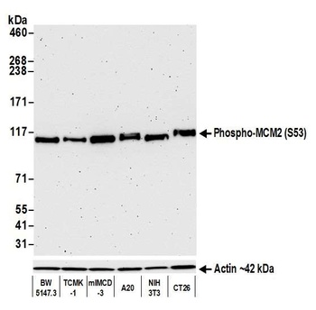 Rabbit Phospho MCM2 (S53) Recombinant Monoclonal Antibody