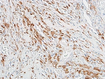 Rabbit ALDH1A1 Recombinant Monoclonal Antibody