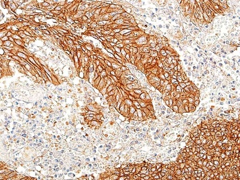 Rabbit E-Cadherin Recombinant Monoclonal Antibody