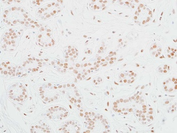 Rabbit MED12 Recombinant Monoclonal Antibody